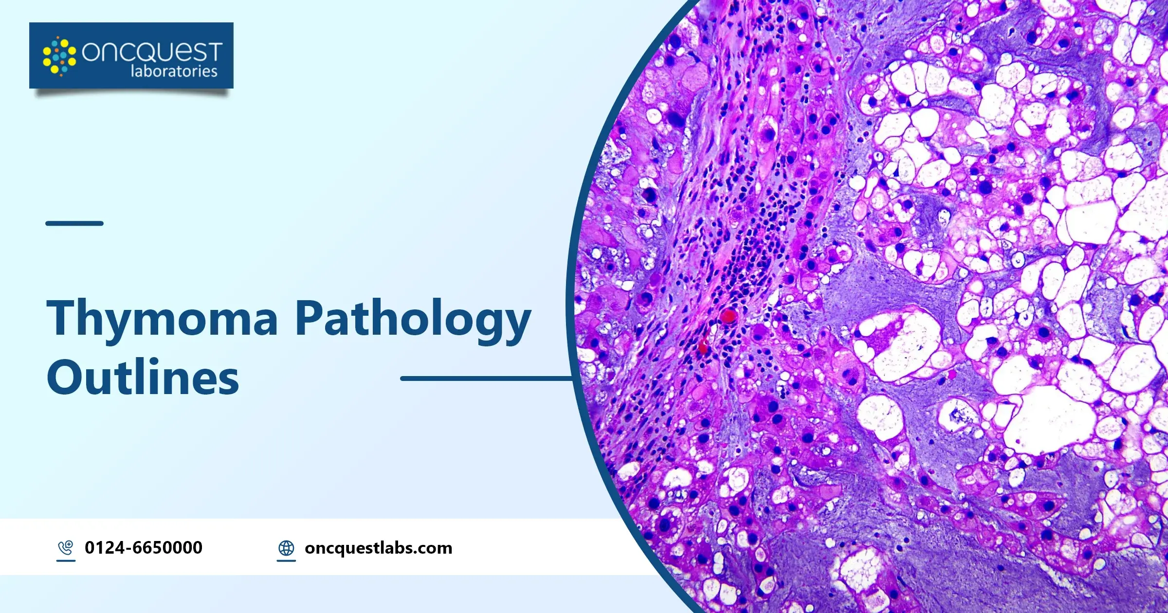 Thymoma Pathology Outlines